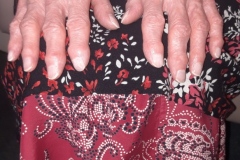 Having our nails done at residential home in Hyde, Charnley House